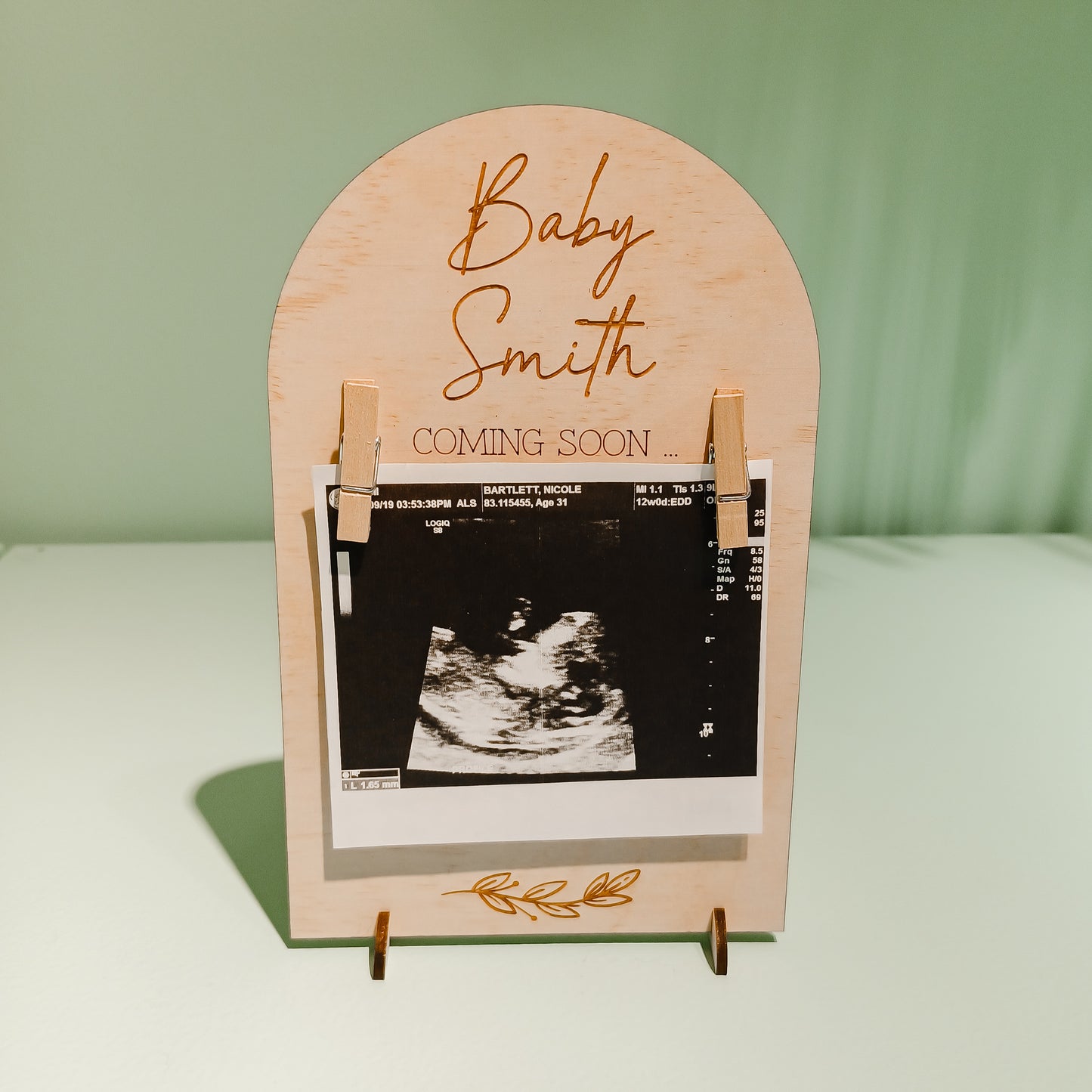 Ultrasound Photo Pregnancy Announcement Plaque