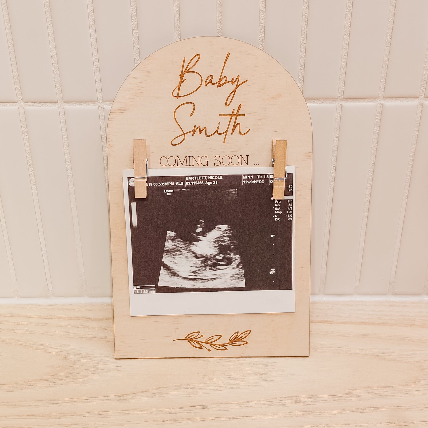 Ultrasound Photo Pregnancy Announcement Plaque